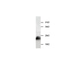 Anti-Cystatin-B(CSTB) Antibody – Figure 1 of 1