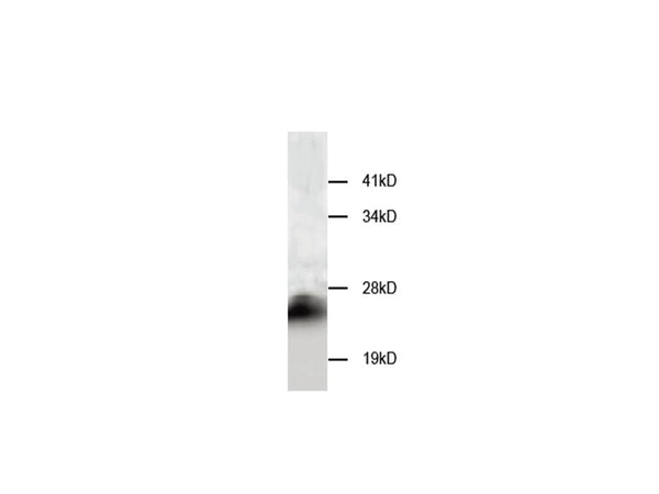 Anti-Cystatin-B(CSTB) Antibody – Figure 1 of 1