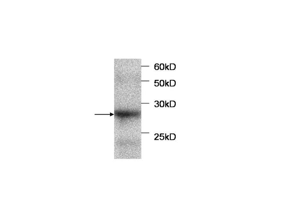 Anti-SCCA2 Antibody – Figure 1 of 1