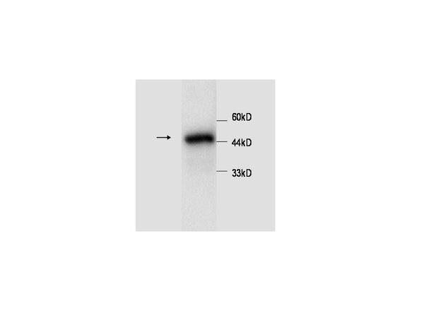Anti-A1AT Antibody – Figure 1 of 1