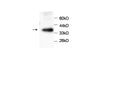 Anti-PRDX3 Antibody – Figure 1 of 1