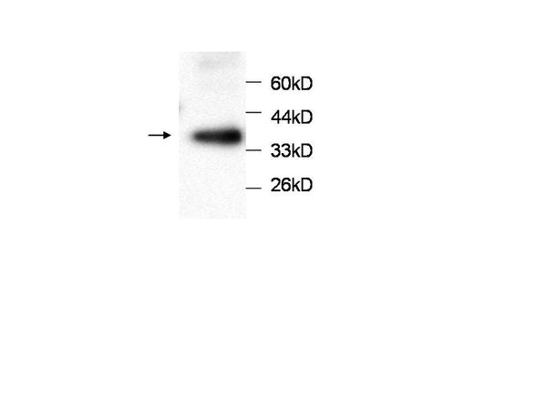 Anti-PRDX3 Antibody – Figure 1 of 1