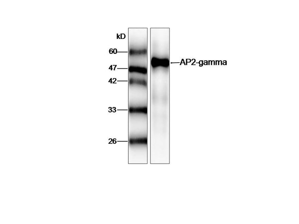 Anti-AP2-gamma Antibody – Figure 1 of 1