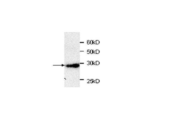 Anti-RFP Antibody – Figure 1 of 1