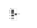 Anti-JEV E-D3 Antibody – Figure 1 of 1