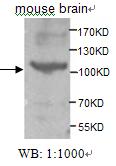 Anti-ACK1 Antibody – Figure 1 of 1