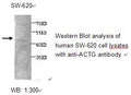 Anti-ACTG1 Antibody – Figure 1 of 1