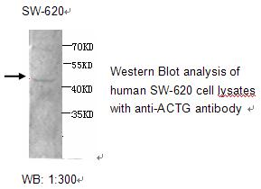 Anti-ACTG1 Antibody – Figure 1 of 1