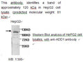 Anti-ADD1 Antibody – Figure 1 of 1