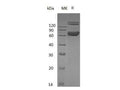 Recombinant Mouse Ephrin-B1/EFNB1 Protein (Fc & His Tag) – Figure 1 of 2