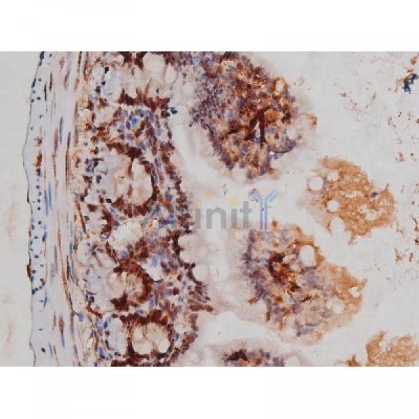 Phospho-Tau (Thr205)[Thr522] Antibody – Figure 1 of 7