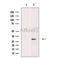 Phospho-SNAIL (Ser11) Antibody – Figure 1 of 9