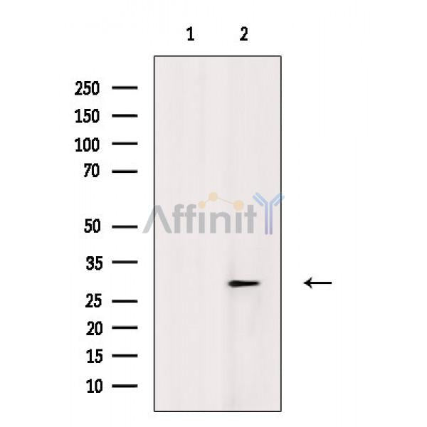 Phospho-SNAIL (Ser11) Antibody – Figure 1 of 9