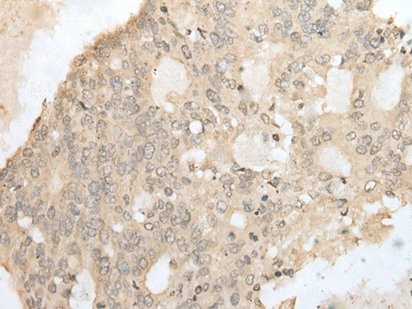 ZZZ3 Polyclonal Antibody – Figure 1 of 3