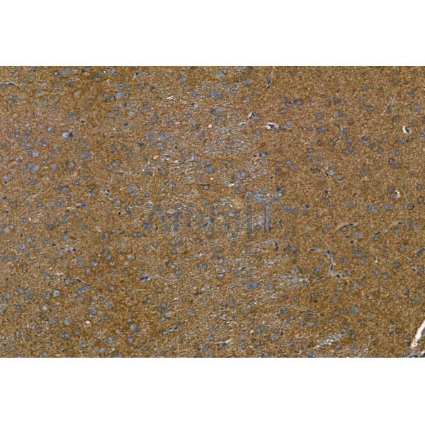Phospho-TGFBR1 (Thr204) Antibody – Figure 1 of 5