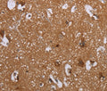 LIMK1 Polyclonal Antibody – Figure 1 of 3