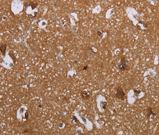 LIMK1 Polyclonal Antibody – Figure 1 of 3