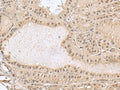 PCLAF Polyclonal Antibody – Figure 1 of 2