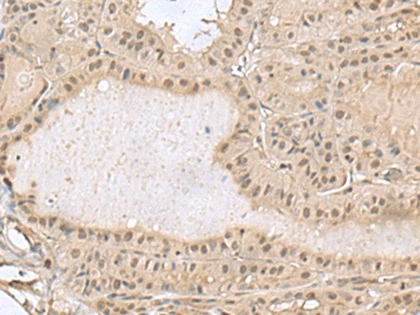 PCLAF Polyclonal Antibody – Figure 1 of 2