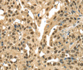 DFFA Polyclonal Antibody – Figure 1 of 3