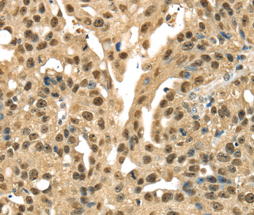 DFFA Polyclonal Antibody – Figure 1 of 3