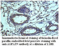 Anti-AGPAT9 Antibody – Figure 1 of 1