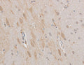 MAP2 Polyclonal Antibody – Figure 1 of 2