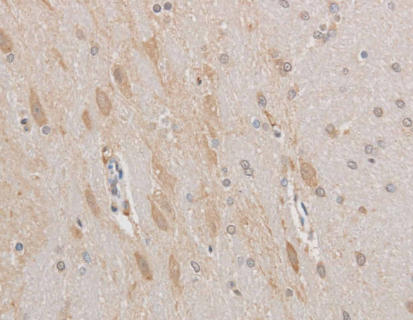 MAP2 Polyclonal Antibody – Figure 1 of 2