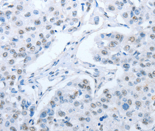ARHGEF2 Polyclonal Antibody – Figure 1 of 3