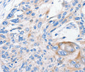 FANCF Polyclonal Antibody – Figure 1 of 2
