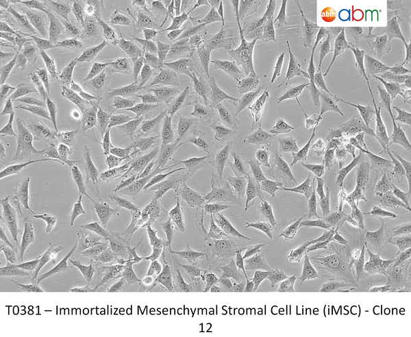 Immortalized Mesenchymal Stromal Cell Line (iMSC) - Clone 12 – Figure 1 of 1