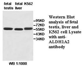 Anti-ALDH1A2 Antibody – Figure 1 of 1