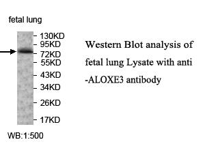 Anti-ALOXE3 Antibody – Figure 1 of 1