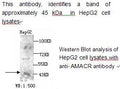 Anti-AMACR Antibody – Figure 1 of 1