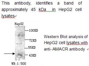 Anti-AMACR Antibody – Figure 1 of 1