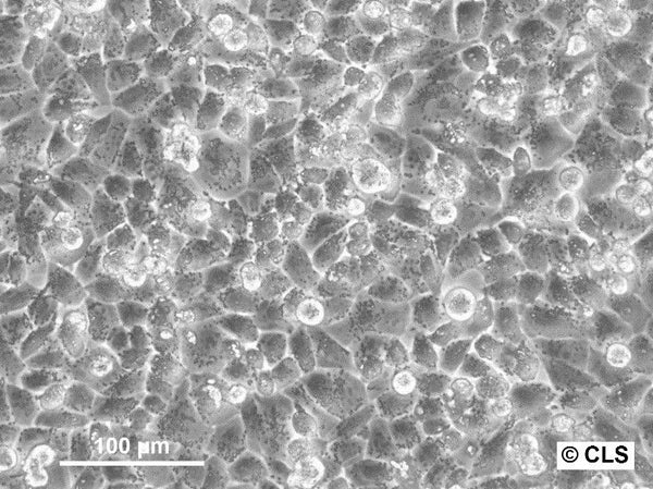 AN3 Ca cell