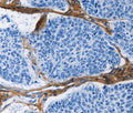 COL3A1 Polyclonal Antibody – Figure 1 of 4