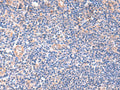 ZNF256 Polyclonal Antibody – Figure 1 of 2