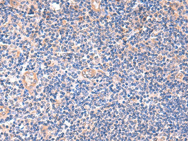 ZNF256 Polyclonal Antibody – Figure 1 of 2