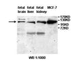 Anti-ANAPC2 Antibody – Figure 1 of 1