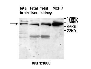 Anti-ANAPC2 Antibody – Figure 1 of 1