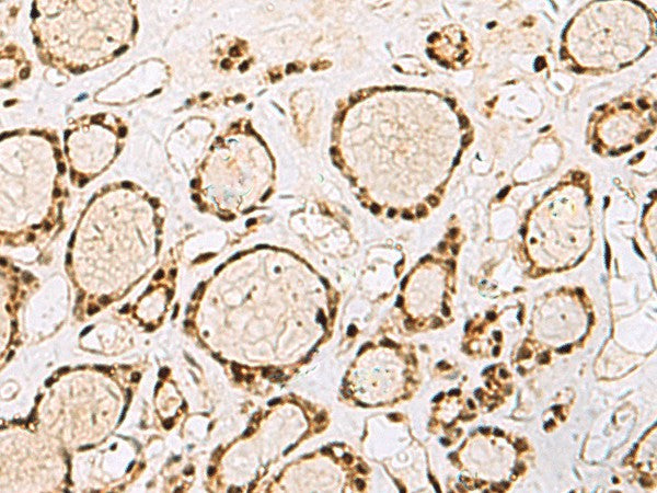 XRCC4 Polyclonal Antibody – Figure 1 of 3