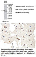 Anti-ANKRD29 Antibody – Figure 1 of 1