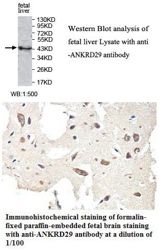 Anti-ANKRD29 Antibody – Figure 1 of 1
