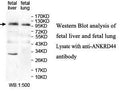 Anti-ANKRD44 Antibody – Figure 1 of 1