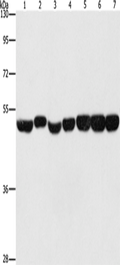 ENO1 Polyclonal Antibody – Figure 1 of 5