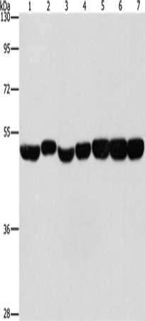 ENO1 Polyclonal Antibody – Figure 1 of 5