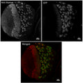Anti-Asense antibody (254 aa C-Term) (STJ140181) – Figure 1 of 1