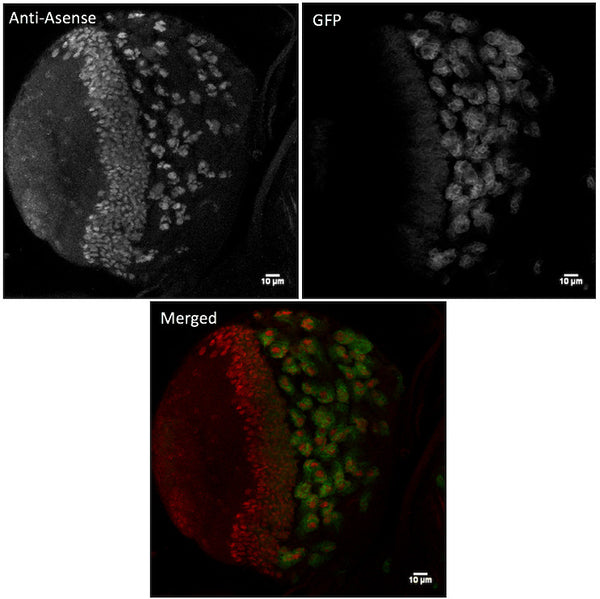 Anti-Asense antibody (254 aa C-Term) (STJ140181) – Figure 1 of 1