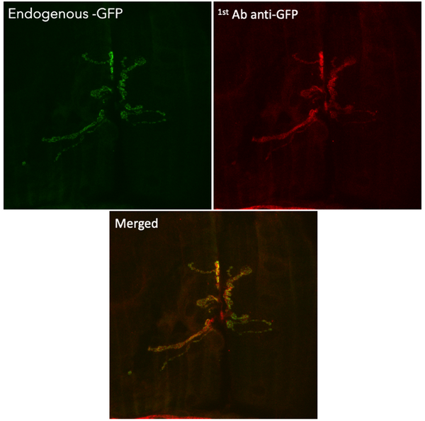 Anti-GFP antibody (STJ140005) – Figure 1 of 1
